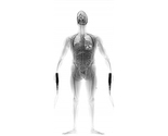 Full Body X-Ray Scanners